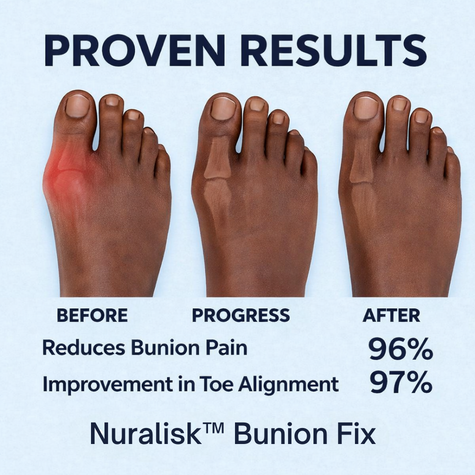 Optilife™ Bunion Fix by Nuralisk